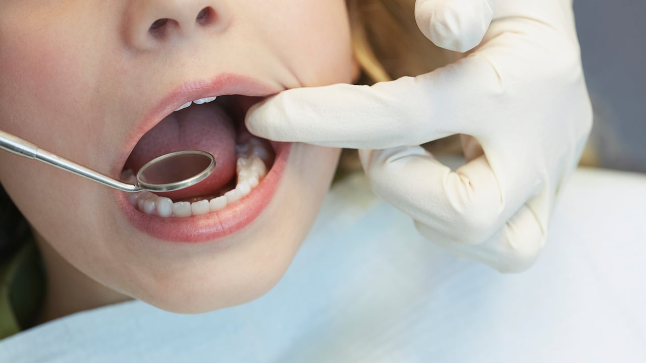 Services dentaires / Enfants / Dents